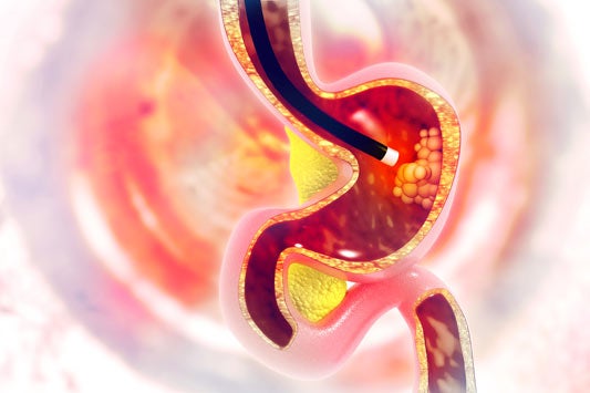 Rendering of endoscopy